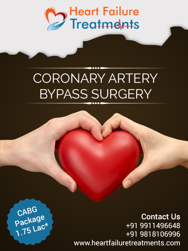Bypass Surgery in Delhi